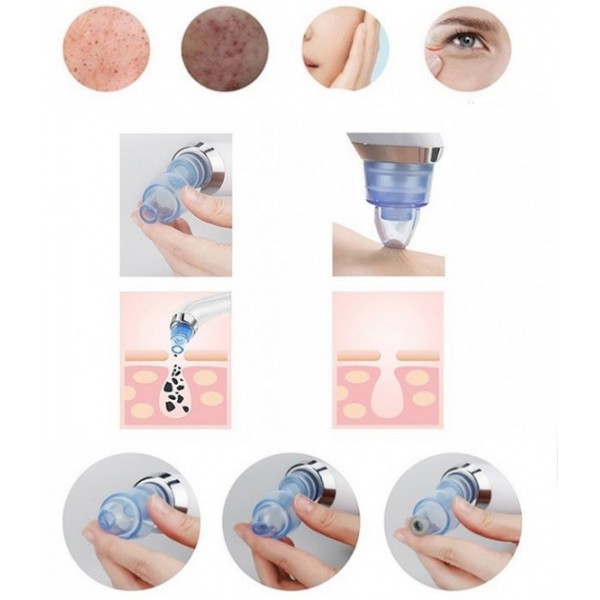 Вакуумний апарат для чищення пор ∙ Апаратна чистка обличчя Derma Suction - Зображення 2
